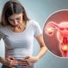 مقاله اندومتریوزیس در ایفای نقش زنانگی